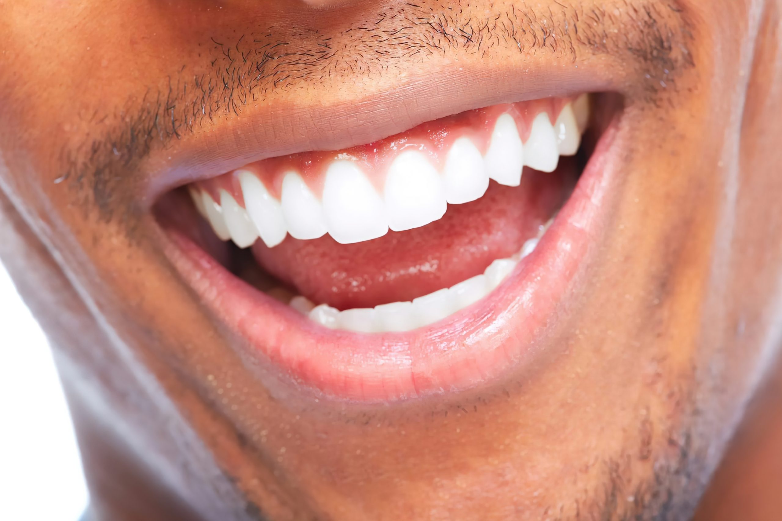 Открытый рот мужчины. Красивые зубы. Идеальные зубы. Белые зубы мужские. Красивая форма зубов.